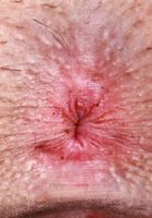 ATK Galleria: Ali Jones (Ali Jones All Nude and Spreading)