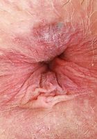 Annie Archer Spreads her Holes, Annie Archer (ann138) ATK Galleria: Annie Archer (Annie Archer Spreads her Holes)