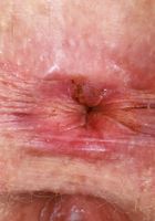 ATK Natural & Hairy: Apricot Pitts (Apricot Pitts Slinky Dress Strip and Spreading)