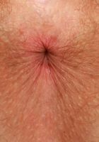 Apricot Pitts Fishnet Spreads, Apricot Pitts (apr024) ATK Natural & Hairy: Apricot Pitts (Apricot Pitts Fishnet Spreads)