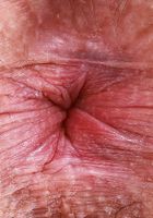 Aubry has a pink wet something she'd like you to look at, Aubry Babcock (aub014) ATK Exotics: Aubry Babcock (Aubry has a pink wet something she'd like you to look at)