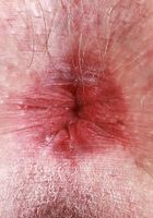 Em Indica Mini Skirt Tease, Em Indica (emi037) ATK Galleria: Em Indica (Em Indica Mini Skirt Tease)