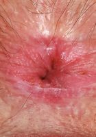 Gigi strips nude outdoors, Gigi (gig009) ATK Natural & Hairy: Gigi (Gigi strips nude outdoors)
