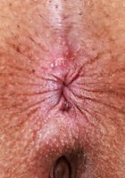 ATK Exotics: Kate Legend (Kate Legend Tight Little Dress)