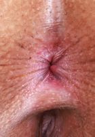 ATK Exotics: Kate Legend (Kate Legend Spreading Shaved Pussy)