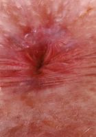 ATK Petites: Krystal Palmer (Krystal Palmer Panty Flash Pussy Spreads)